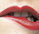 chelitis image