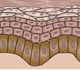 Keratinocyte Image